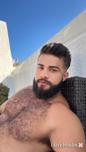 Top hairy guy